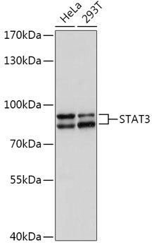 Anti-STAT3 Antibody [KO Validated] (CAB1192)