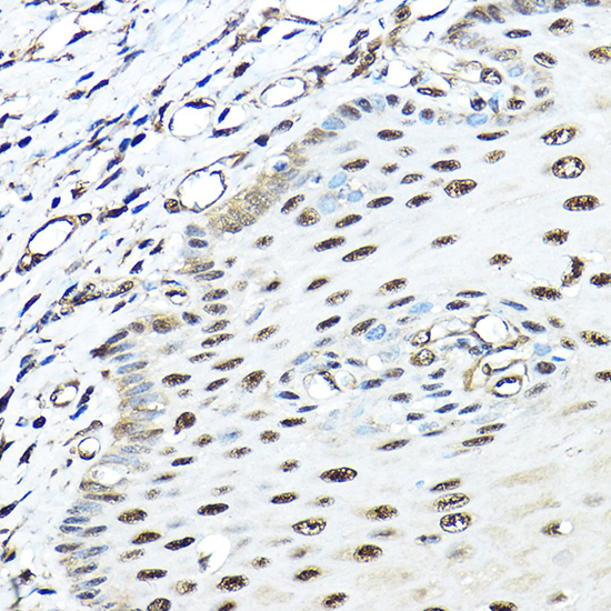 Anti-VCP Antibody (CAB2795)