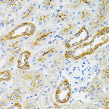 Anti-AIFM3 Polyclonal Antibody (CAB8597)