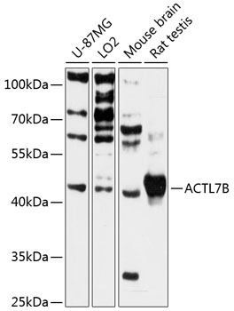 Anti-ACTL7B Antibody (CAB13149)