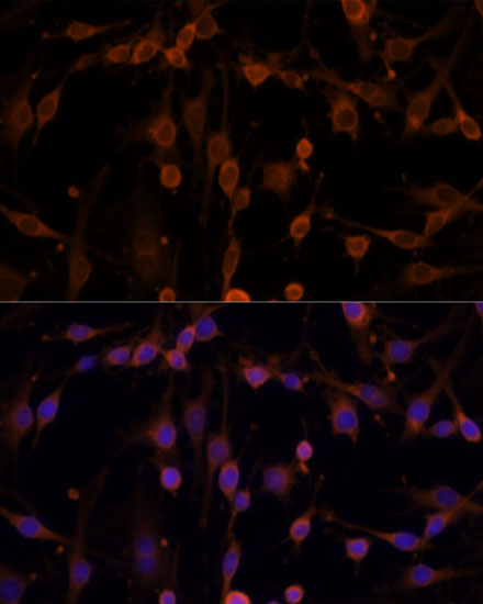 Anti-NME1 Antibody (CAB0259)