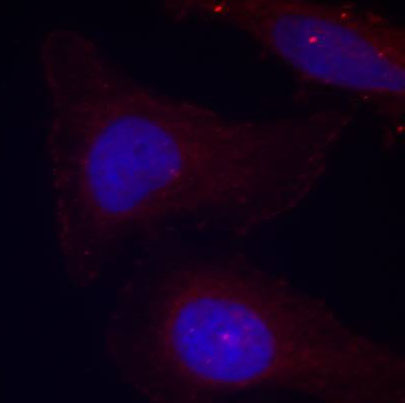 Anti-Phospho-PTK2B-Y402 Antibody (CABP0214)