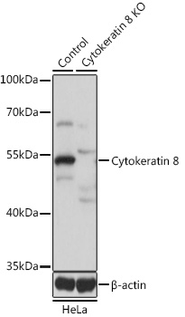 Anti-Cytokeratin 8 Antibody [KO Validated] (CAB1024)