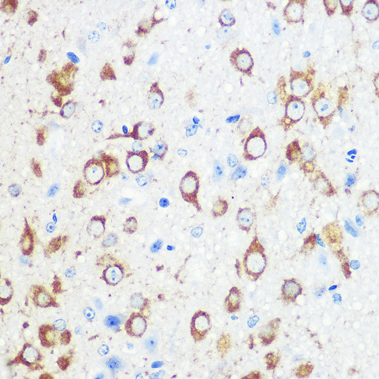 Anti-APBA1 Antibody (CAB18582)