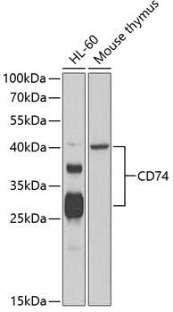 Anti-CD74 Antibody (CAB13958)