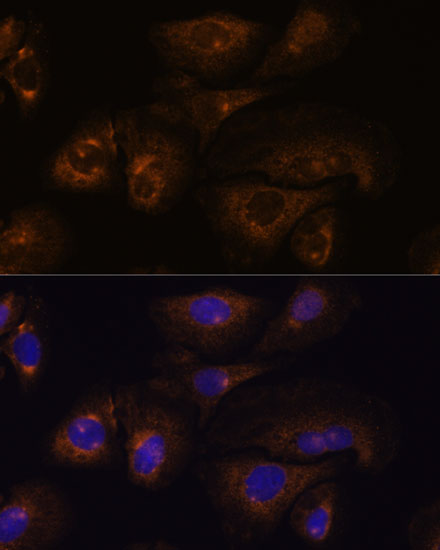 Anti-PRSS8 Antibody (CAB16419)