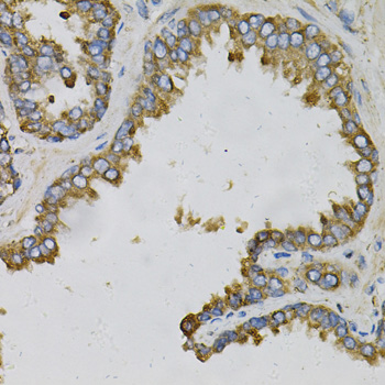 Anti-EFNA1 Antibody (CAB5341)