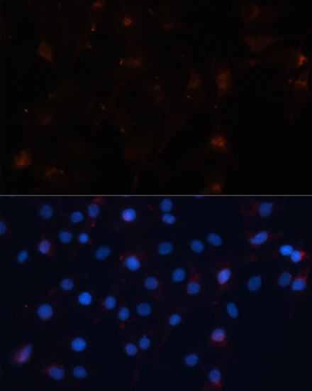 Anti-UBL3 Antibody (CAB4028)