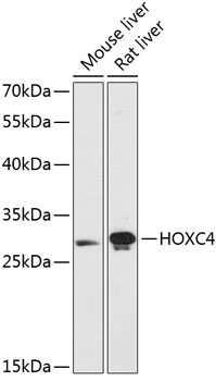 Anti-HOXC4 Antibody (CAB13856)