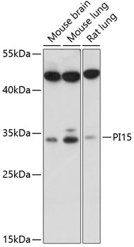 Anti-PI15 Antibody (CAB14886)