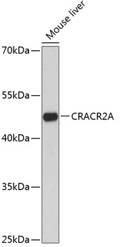 Anti-CRACR2A Antibody (CAB13838)