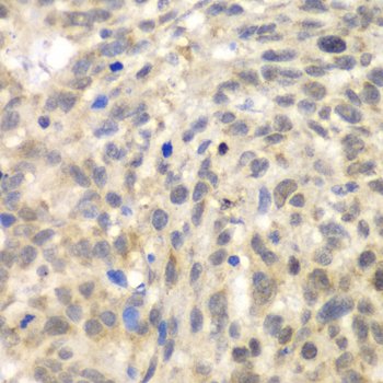 Anti-TLK2 Antibody [KO Validated] (CAB6770)