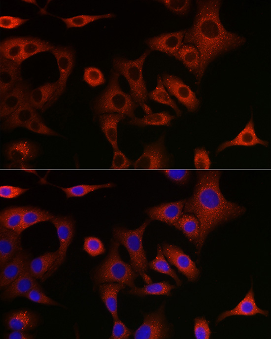 Anti-SQSTM1 / p62 Antibody (CAB11247)