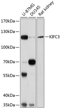 Anti-KIFC3 Polyclonal Antibody (CAB8617)