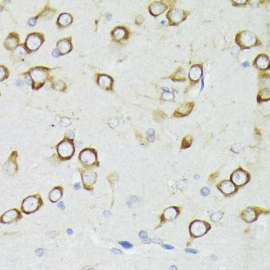 Anti-PDPK1 Antibody (CAB1665)