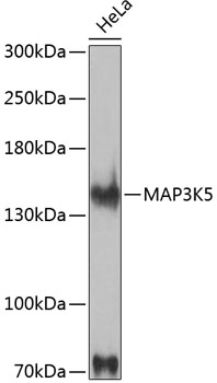 Anti-MAP3K5 Antibody (CAB12458)