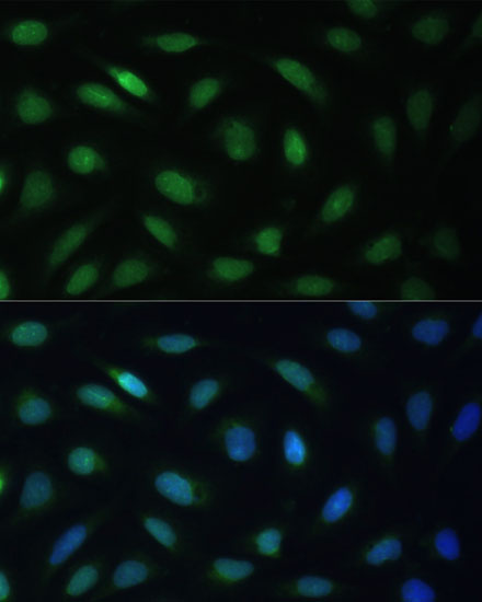 Anti-LBR Antibody (CAB5468)