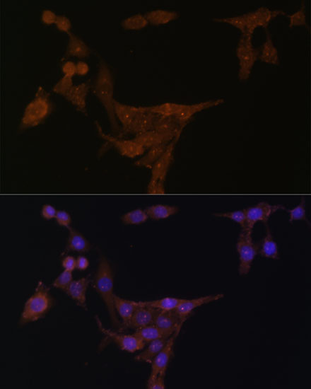 Anti-PPAT Antibody (CAB6698)