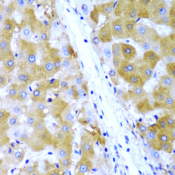 Anti-TIRAP Antibody (CAB1943)