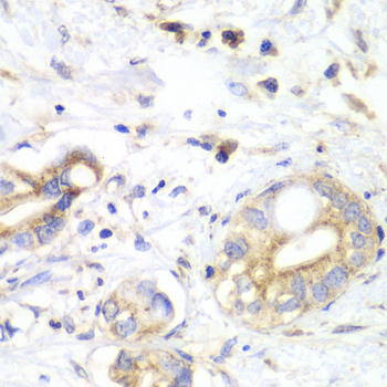 Anti-TXN2 Antibody (CAB12591)