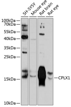 Anti-CPLX1 Antibody (CAB11588)