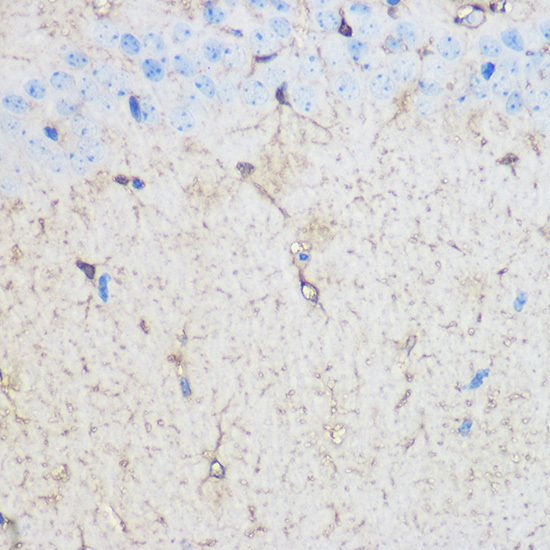 Anti-S100B Antibody (CAB0676)