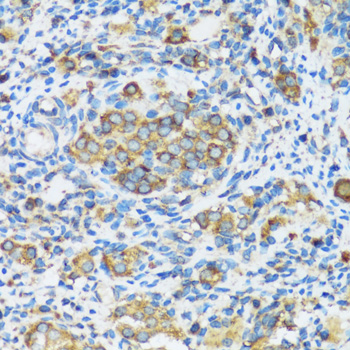 Anti-APOBEC3F Antibody (CAB2507)