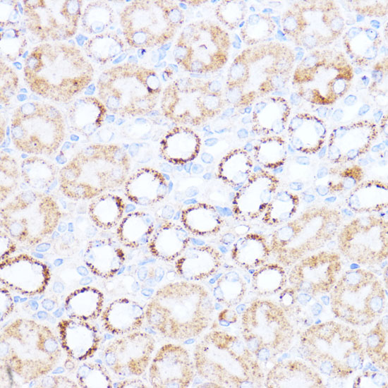 Anti-ACAT1 Antibody (CAB13273)