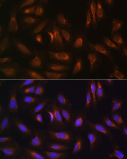 Anti-NRBF2 Antibody (CAB6462)