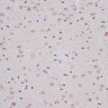 Anti-NFE2L1 Antibody (CAB14753)