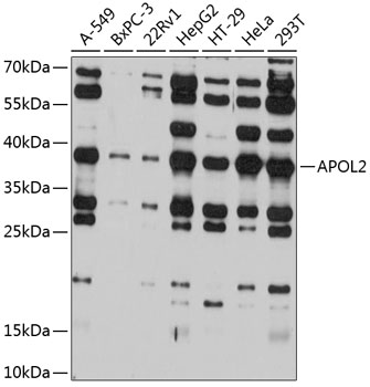 Anti-APOL2 Antibody (CAB12202)