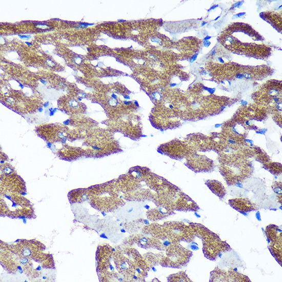 Anti-TIMMDC1 Antibody (CAB15839)