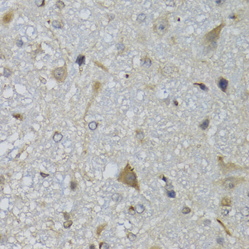 Anti-CHN1 Antibody (CAB7546)