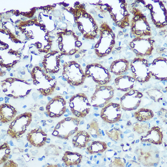 Anti-UQCRFS1 Antibody (CAB6784)