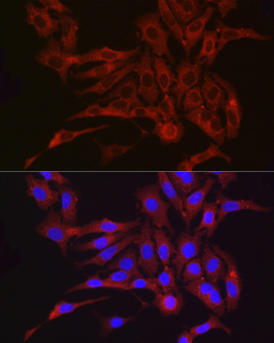 Anti-FURIN Antibody (CAB7445)