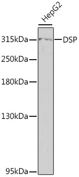 Anti-DSP Antibody (CAB13299)