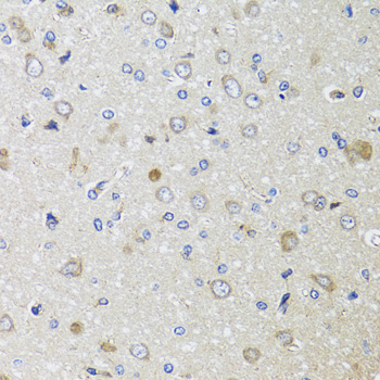 Anti-beta 2 Microglobulin Antibody [KO Validated] (CAB12404)