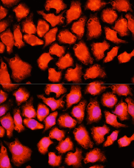 Anti-ACO2 Antibody (CAB3716)