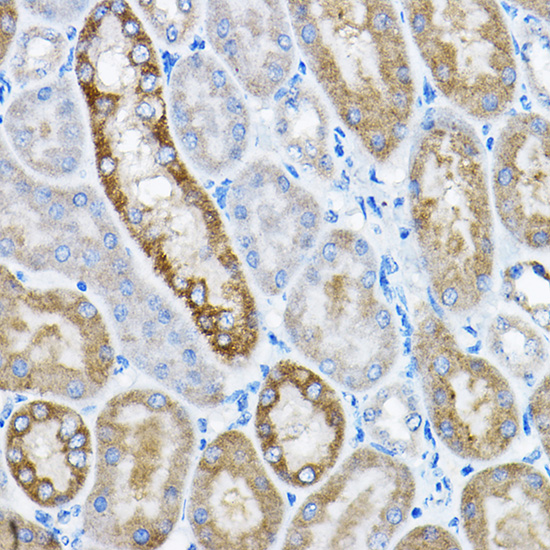 Anti-GRPEL2 Polyclonal Antibody (CAB8339)