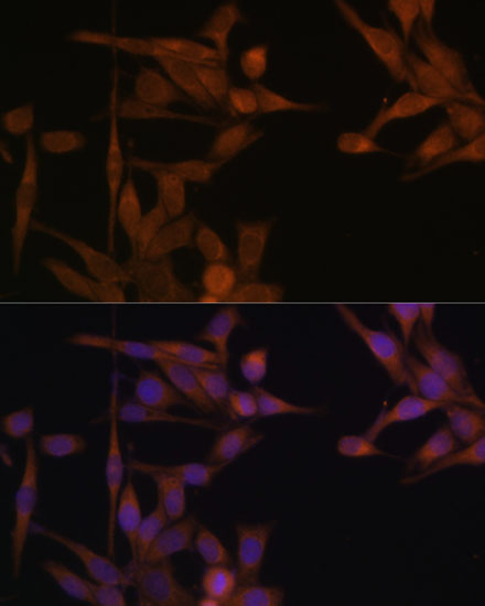 Anti-PPP2CA Antibody (CAB6702)