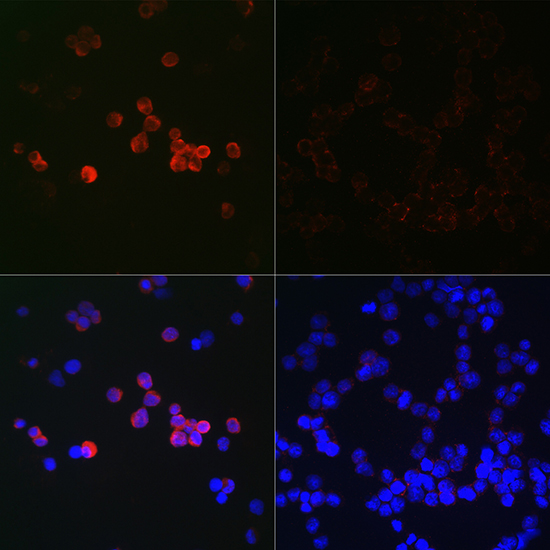 Anti-LC3B Antibody (CAB11280)