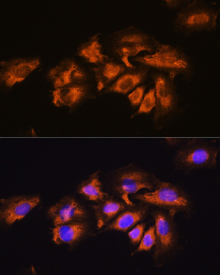 Anti-ADRA1A Antibody (CAB1471)