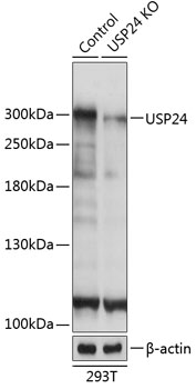 Anti-USP24 Antibody [KO Validated] (CAB20003)