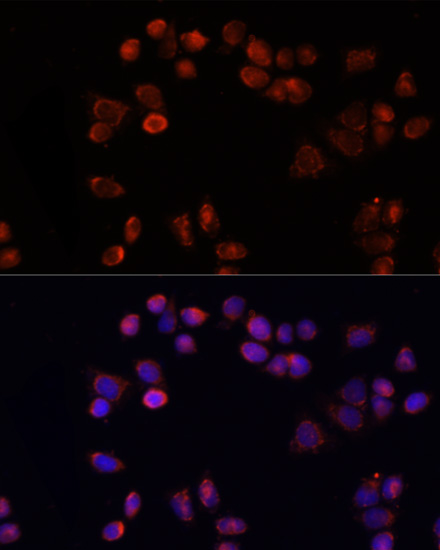 Anti-SLC25A4 Antibody (CAB15027)