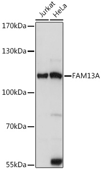 Anti-FAM13A Antibody (CAB14576)