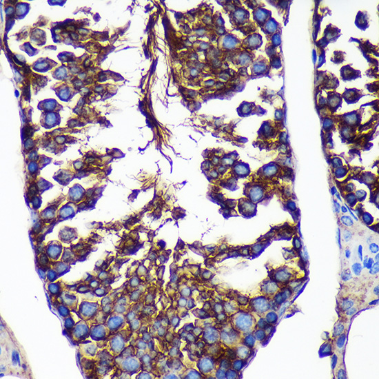 Anti-CTNNA3 Antibody (CAB16519)