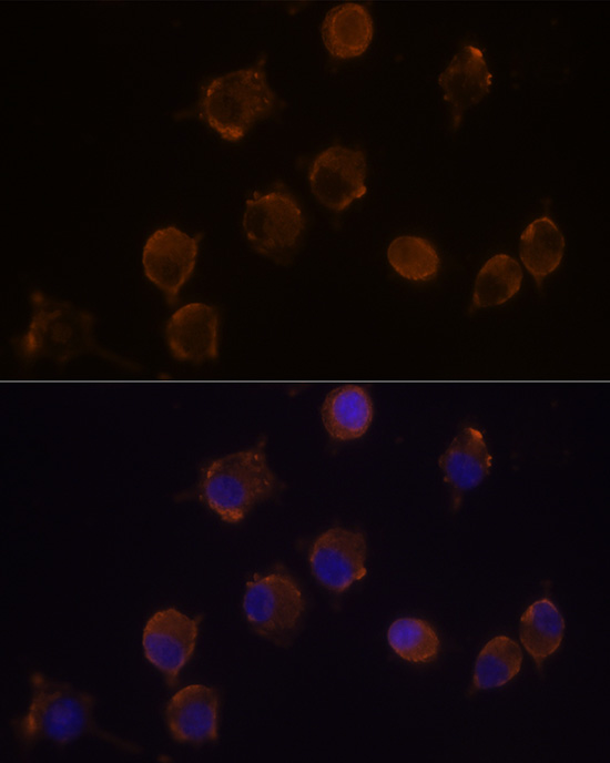 Anti-IL-10RA Antibody (CAB1830)