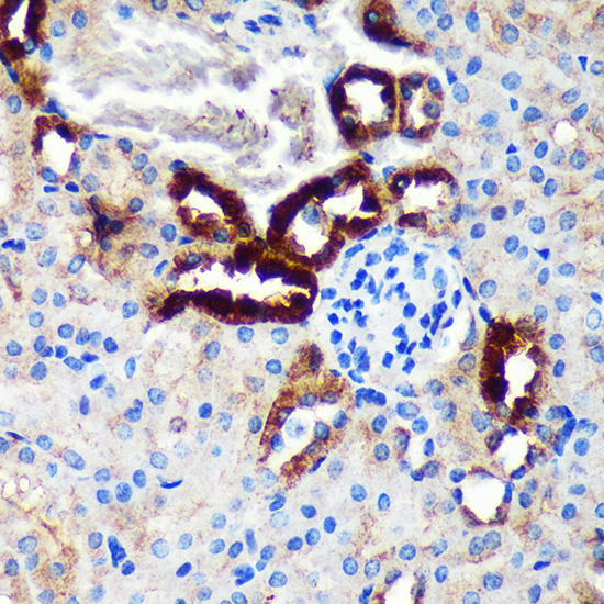 Anti-EML4 Antibody (CAB16117)