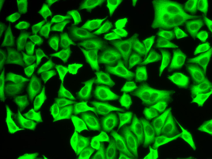 Anti-ALDH4A1 Antibody (CAB2595)