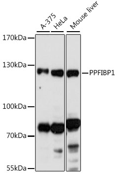 Anti-PPFIBP1 Antibody (CAB16456)